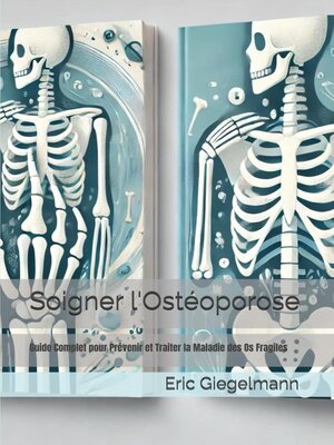 cover image of Soigner l'Ostéoporose